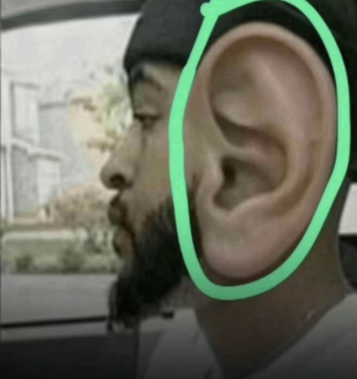 Ear Large